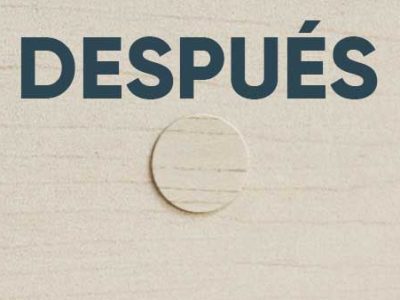 DESPUES